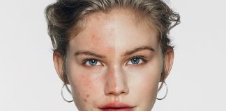 Dissimulez vos imperfections avec Dermablend!