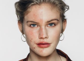 Dissimulez vos imperfections avec Dermablend!